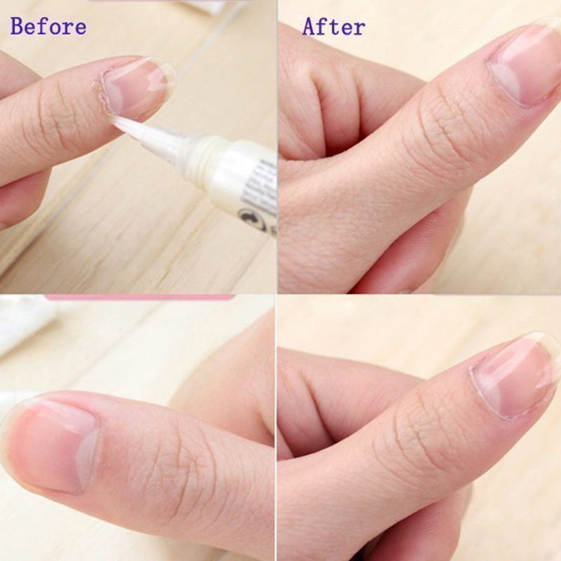 1 Stück Nagelhautöl-Stift, Nag – Cuticle Oil Pen Bewertung und Preis